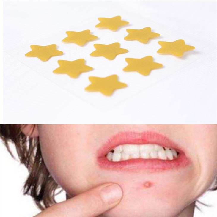 acne and dark spot removal